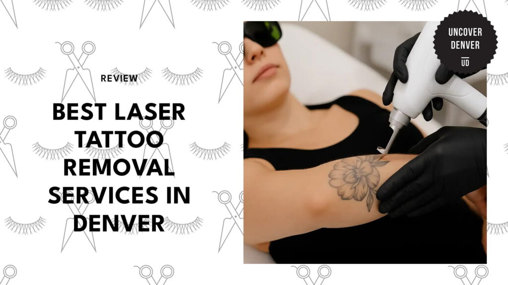 The 5 Best Laser Tattoo Removal Services in Denver for Effective Results