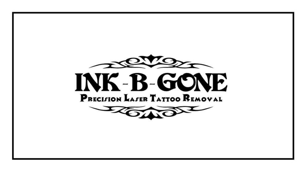 ink-b-gone-tattoo-removal-denver