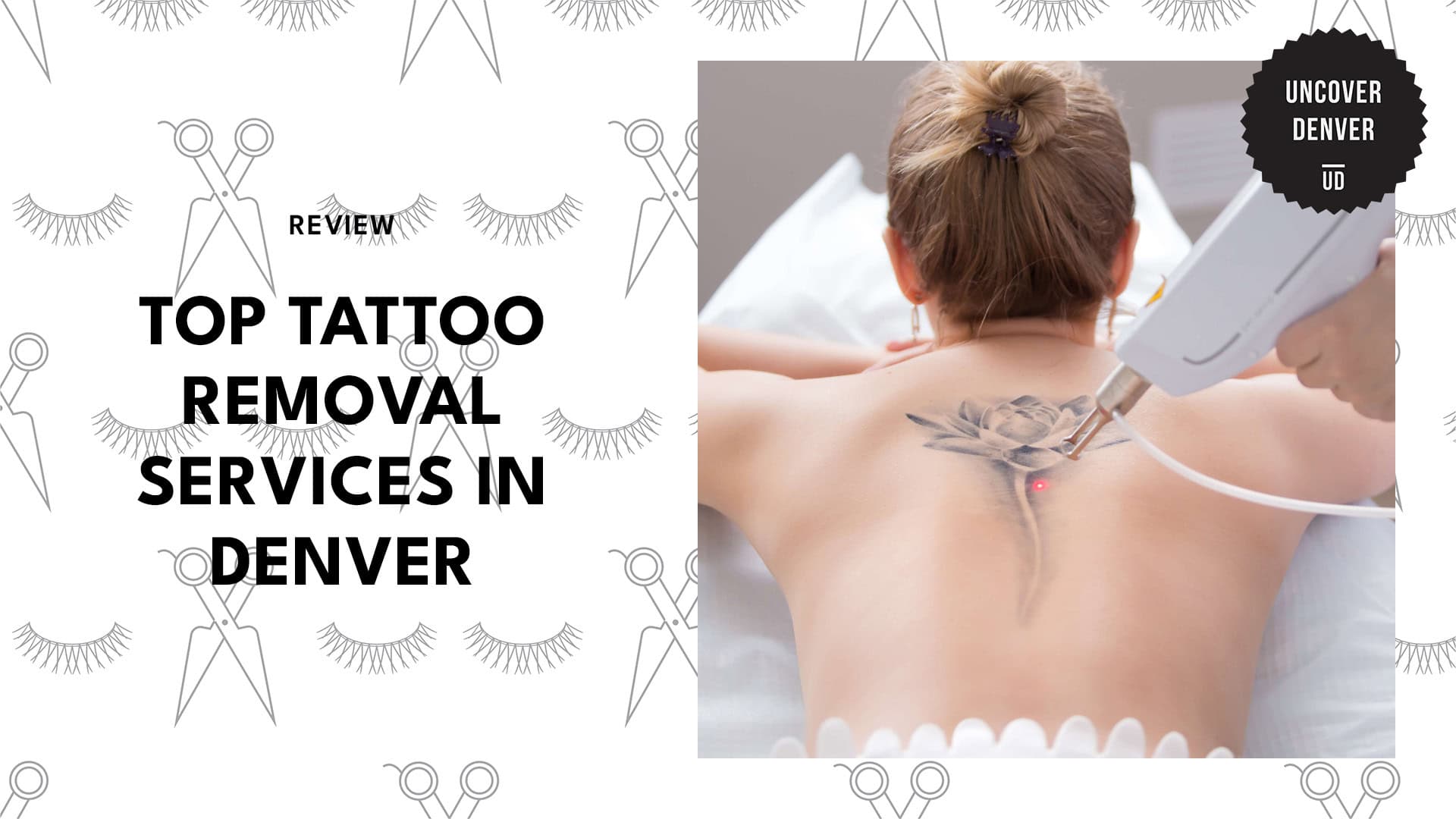 tattoo-removal-services-in-denver