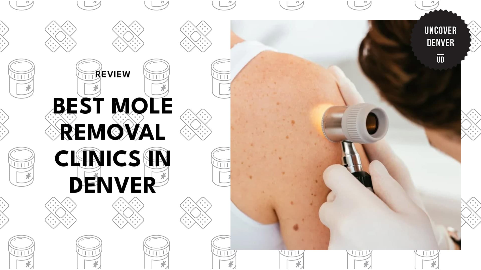 mole-removal-clinics-in-denver